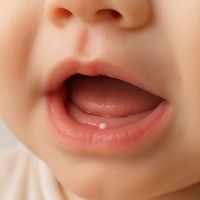 Point blanc sur la gencive de bébé : normal ?